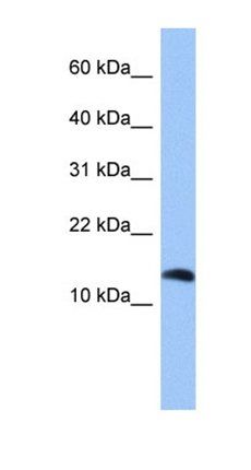 PTH2 antibody