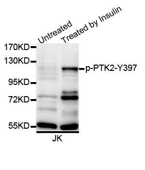 PTK2 (phospho-Y397) antibody