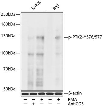 PTK2 (Phospho-Y576/577) antibody