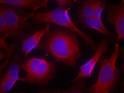 PTK2B (Ab-402) Antibody