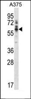 Ptk6 antibody