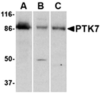 PTK7 Antibody