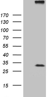 PTK9 (TWF1) antibody
