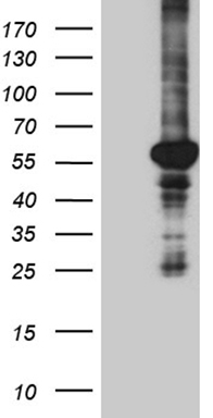 PTK9 (TWF1) antibody