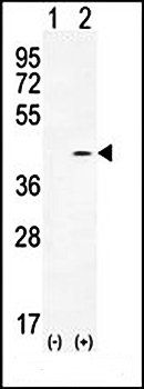 PTK9L antibody