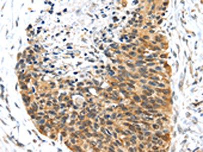 PTMA Antibody