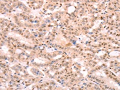 PTMA Antibody