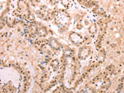 PTMA Antibody