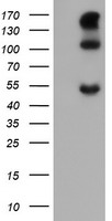 PTOP Antibody