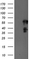 PTP1B (PTPN1) antibody