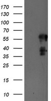 PTP1B Antibody