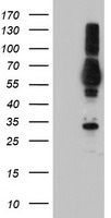 PTP1B (PTPN1) antibody