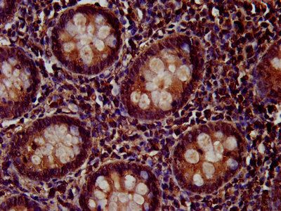 PTP4A2 Antibody