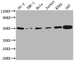 PTPN1 Recombinant Monoclonal Antibody