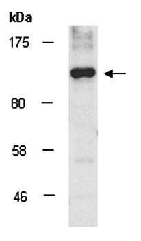 PTPN14 antibody