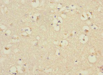PTPN18 Antibody