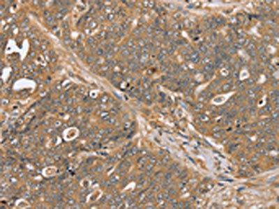 PTPN20A; Antibody