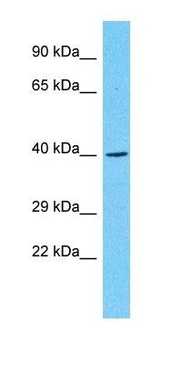 PTPN20B antibody