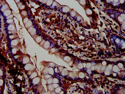 PTPN3 Antibody