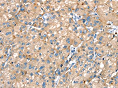 PTPN3 Antibody