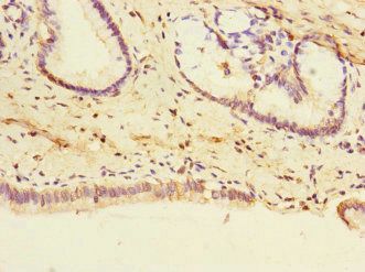 PTPN4 antibody