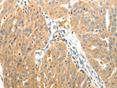 PTPN6 Antibody