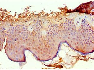 PTPRA Antibody