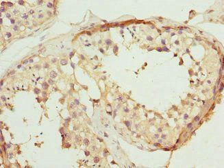 PTPRB antibody