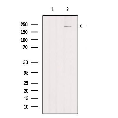 PTPRB Antibody