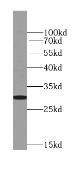 PTPRCAP antibody