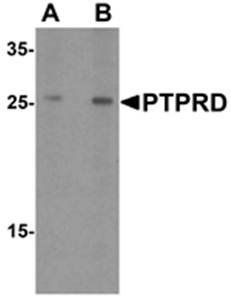 PTPRD Antibody