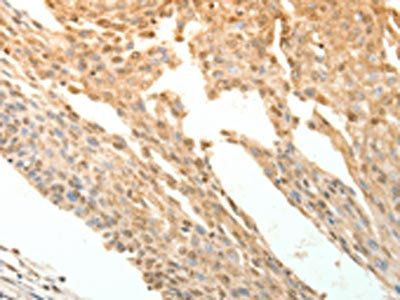 PTPRE Antibody