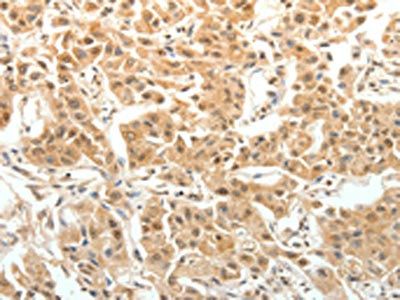 PTPRE Antibody