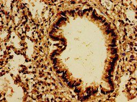 PTPRF Antibody
