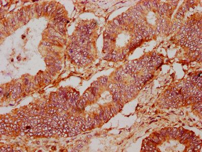 PTPRK Antibody