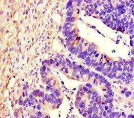 PTPRS Antibody