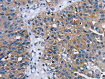 PTRH2 Antibody