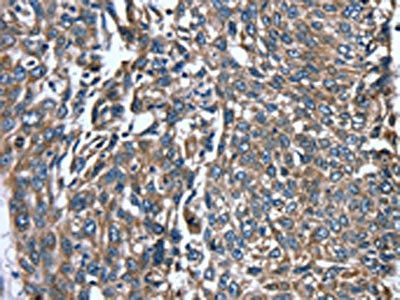 PTRH2 Antibody