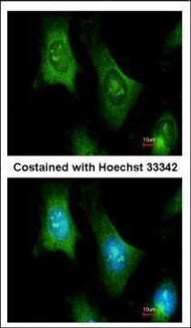 PTS antibody