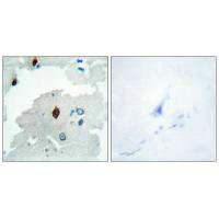 PTTG1IP antibody