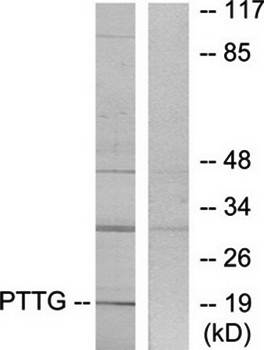 PTTG antibody