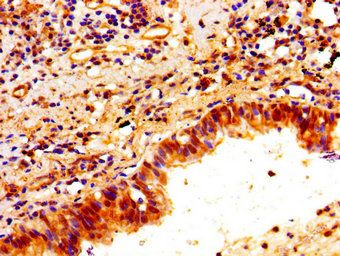 PTX3 Antibody