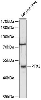 PTX3 antibody