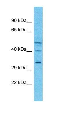 PTX4 antibody