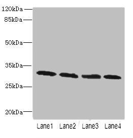 Purine nucleoside phosphorylase antibody