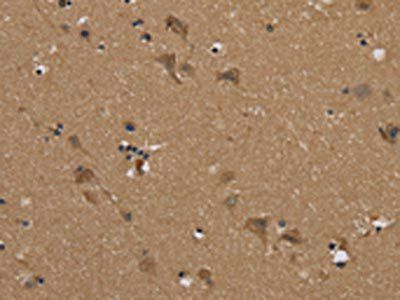 PUS10 Antibody