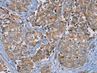 PUS10 Antibody