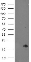 PUS7 antibody