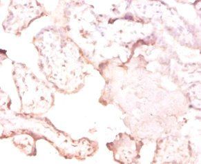 Putative tRNAcytidine(32)/guanosine(34)-2'-O)-methyltransferase antibody