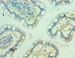 PVR Antibody
